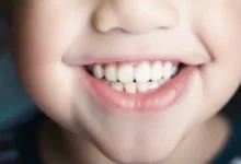 Tiny Teeth, Big Impact: Why Baby Teeth Care Matters